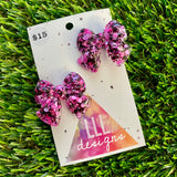 Handmade Resin Hair Clip - Pink and Black Confetti - Medium Chunky Bow Hair Clip Pair!